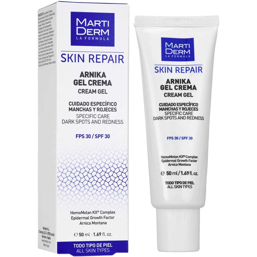 Martiderm Arnika Cream Gel 50ml